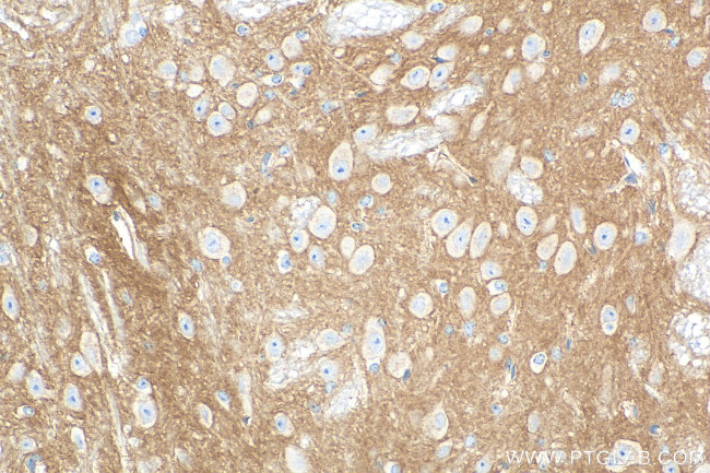 CD200 Antibody in Immunohistochemistry (Paraffin) (IHC (P))