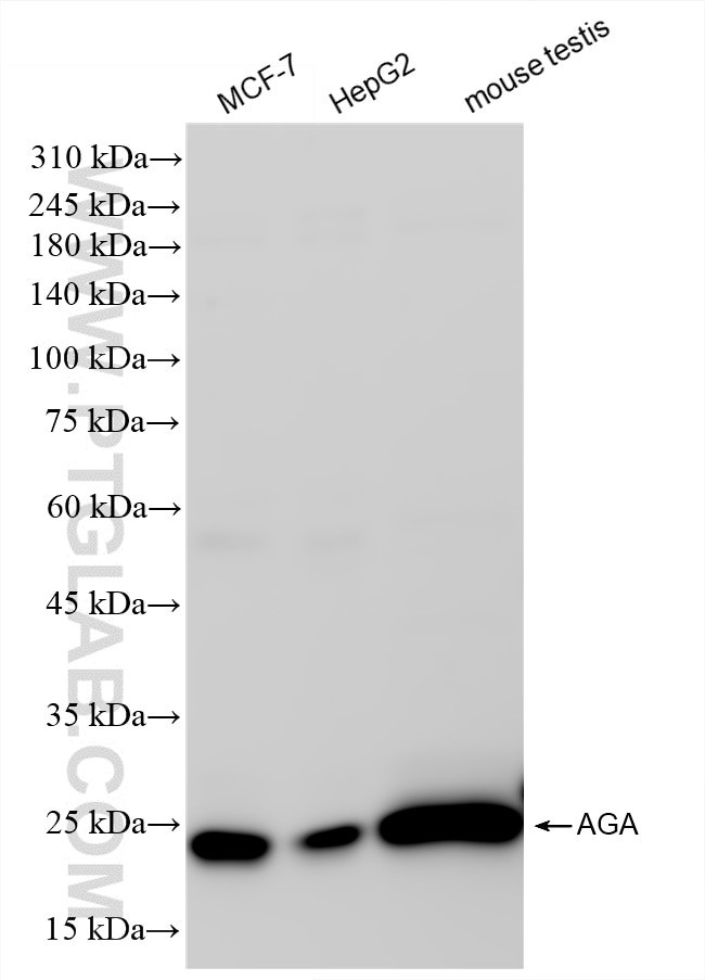 AGA Antibody in Western Blot (WB)