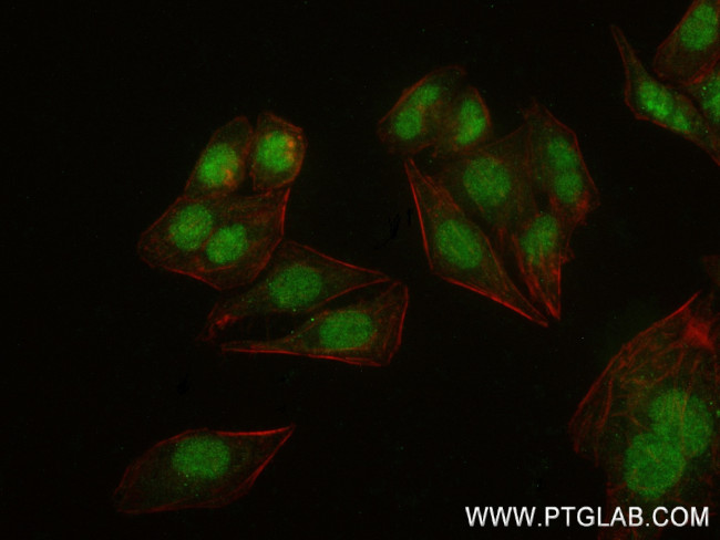 ESR2 Antibody in Immunocytochemistry (ICC/IF)