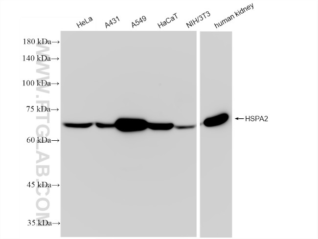 HSPA2 Antibody in Western Blot (WB)