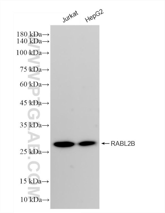 RABL2B Antibody in Western Blot (WB)