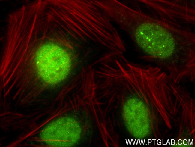 IKZF4 Antibody in Immunocytochemistry (ICC/IF)
