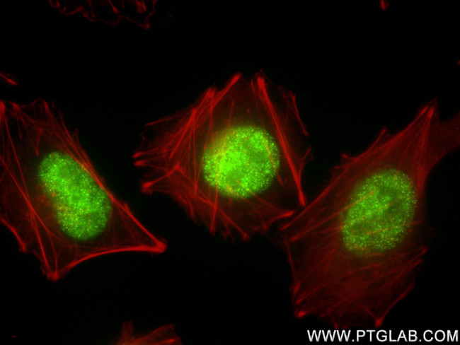 FOXC2 Antibody in Immunocytochemistry (ICC/IF)