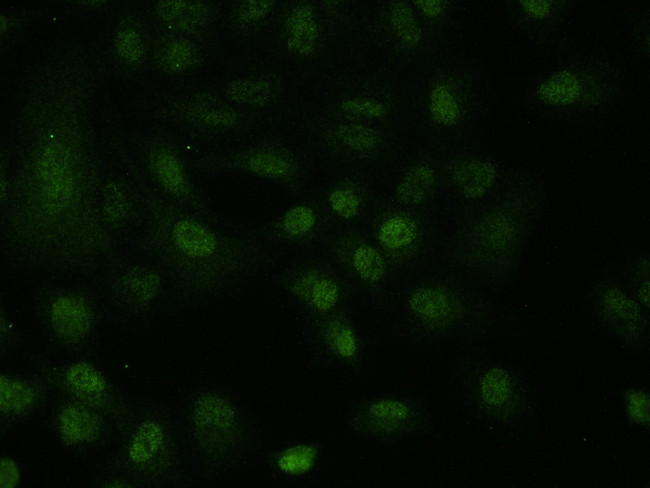 MAGEA3 Antibody in Immunocytochemistry (ICC/IF)