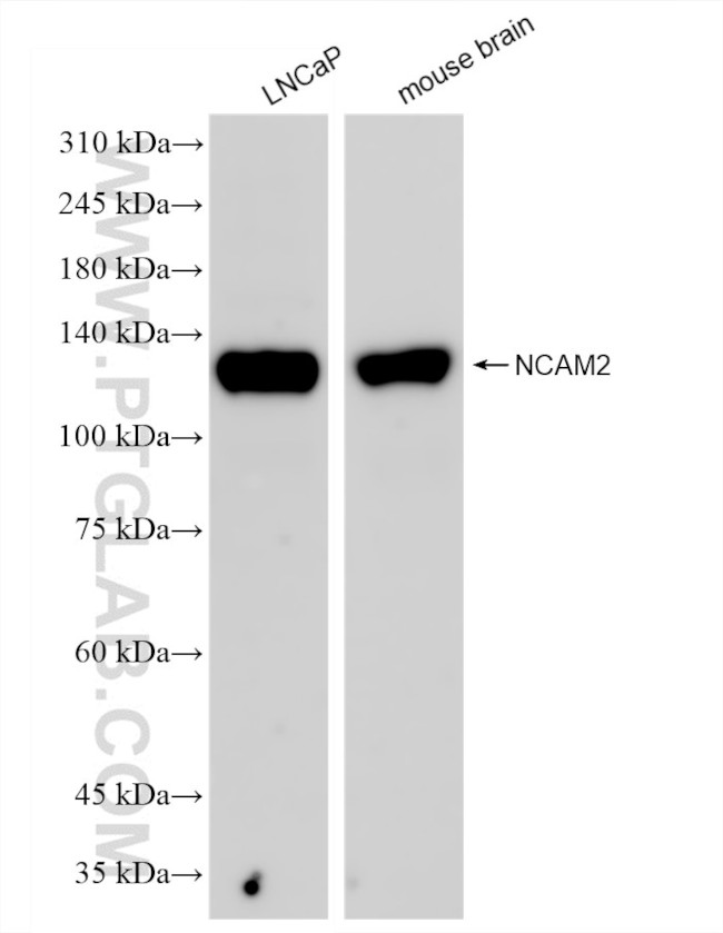 NCAM2 Antibody in Western Blot (WB)
