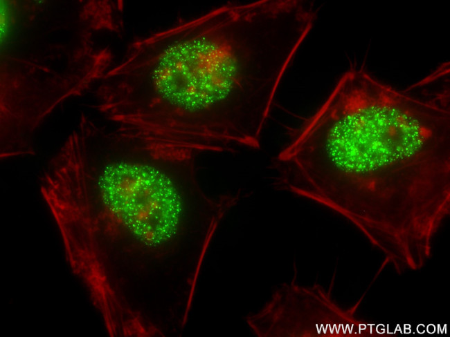 MDC1 Antibody in Immunocytochemistry (ICC/IF)