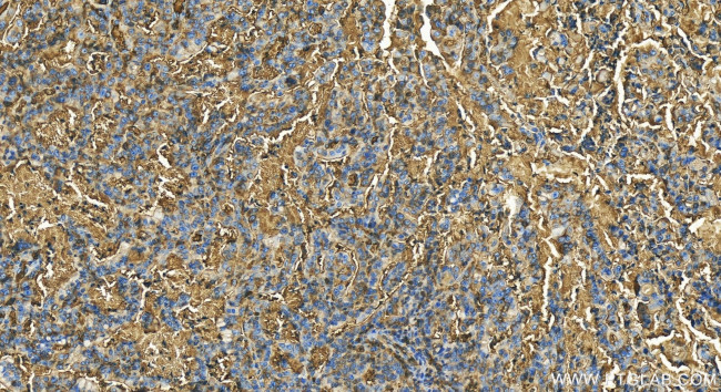 Apolipoprotein AI Antibody in Immunohistochemistry (Paraffin) (IHC (P))