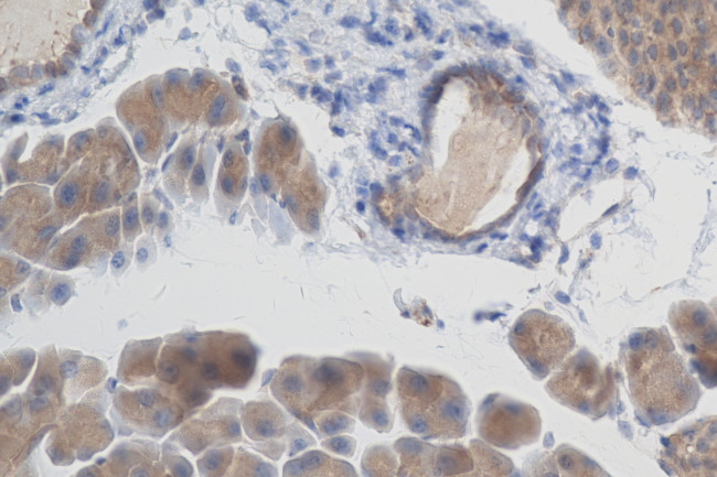 SLC17A9 Antibody in Immunohistochemistry (Paraffin) (IHC (P))
