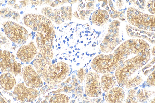 Osteoprotegerin/TNFRSF11B Antibody in Immunohistochemistry (Paraffin) (IHC (P))