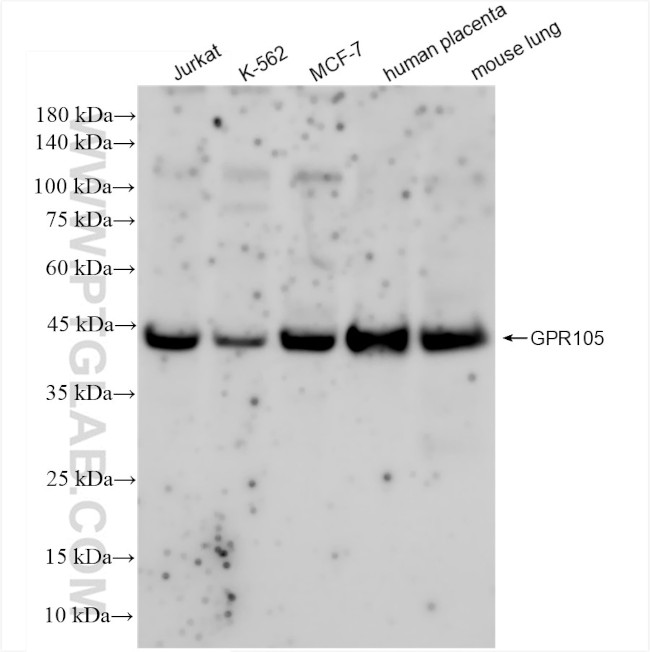 GPR105 Antibody in Western Blot (WB)