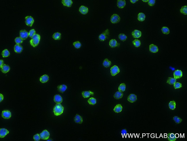 CD4 Antibody in Immunocytochemistry (ICC/IF)