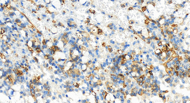 Integrin beta-5 Antibody in Immunohistochemistry (Paraffin) (IHC (P))