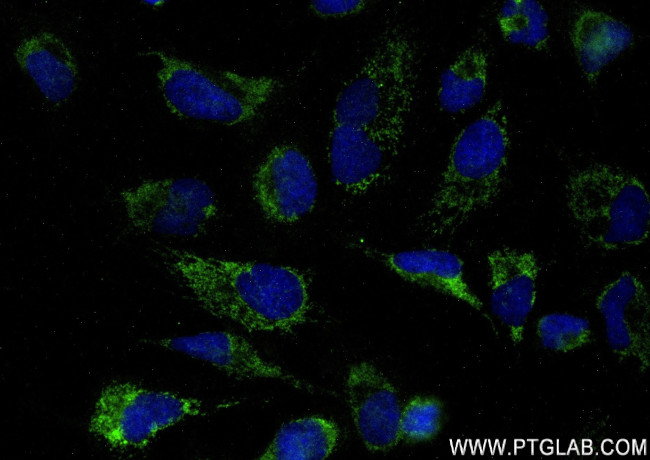 MRPL40 Antibody in Immunocytochemistry (ICC/IF)