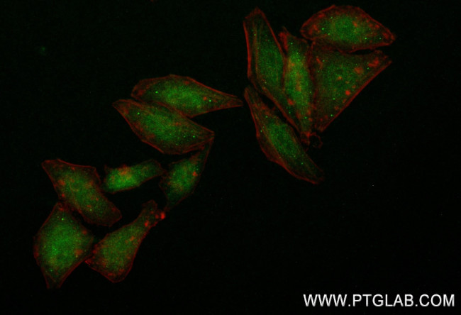 RPS11 Antibody in Immunocytochemistry (ICC/IF)