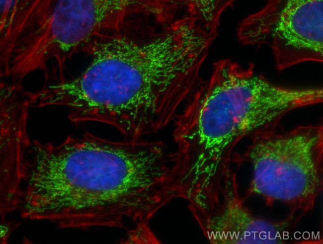 SOD2 Antibody in Immunocytochemistry (ICC/IF)