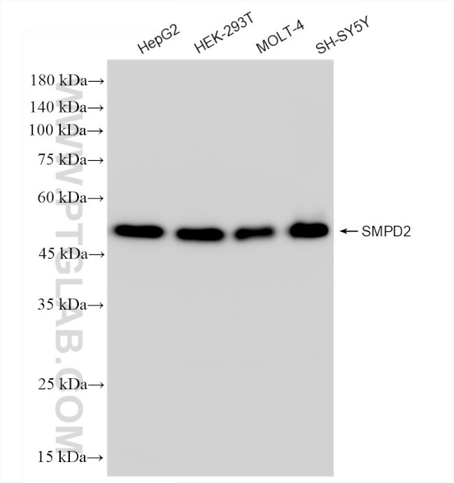 SMPD2 Antibody in Western Blot (WB)
