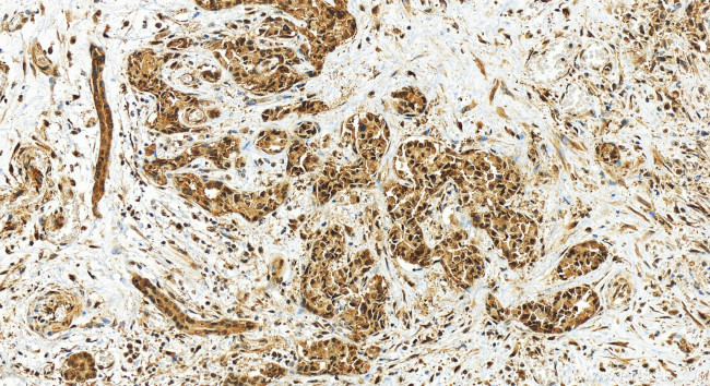 PSMD1 Antibody in Immunohistochemistry (Paraffin) (IHC (P))