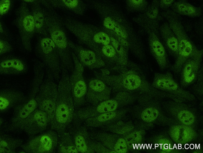 PSMD1 Antibody in Immunocytochemistry (ICC/IF)