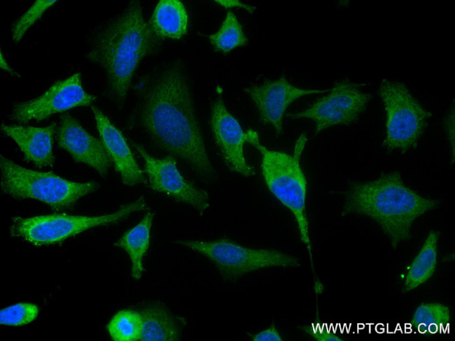 ERK1/2 Antibody in Immunocytochemistry (ICC/IF)