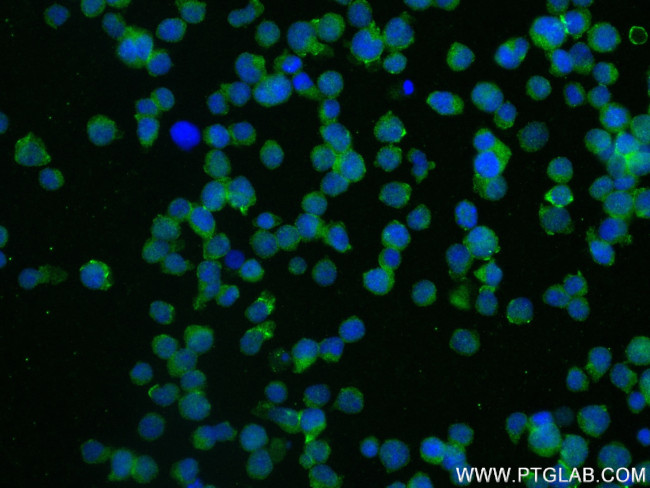 TIGIT Antibody in Immunocytochemistry (ICC/IF)