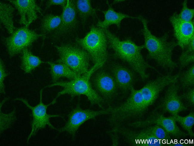 MBOAT7 Antibody in Immunocytochemistry (ICC/IF)