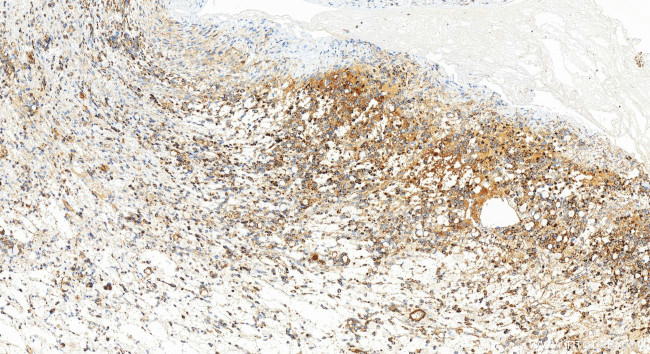 LONP1 Antibody in Immunohistochemistry (Paraffin) (IHC (P))