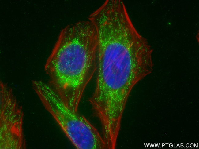 LONP1 Antibody in Immunocytochemistry (ICC/IF)