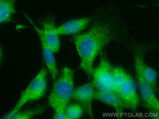 Gsdmd Antibody in Immunocytochemistry (ICC/IF)
