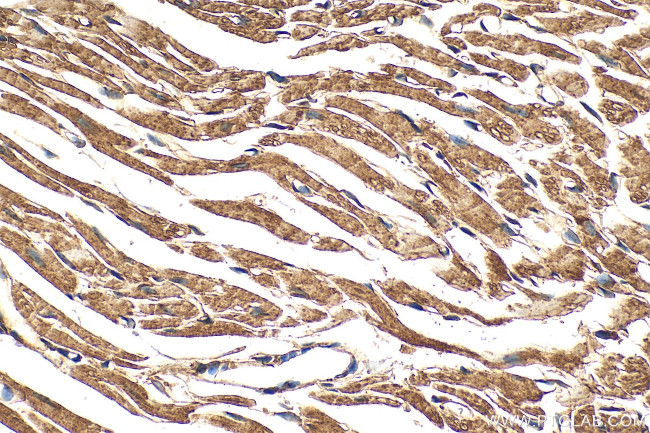 CORIN Antibody in Immunohistochemistry (Paraffin) (IHC (P))