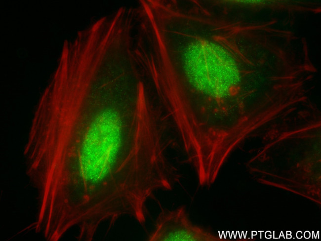 ANAPC10 Antibody in Immunocytochemistry (ICC/IF)