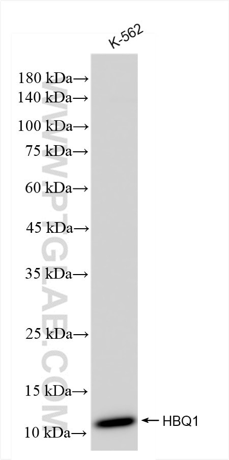 HBQ1 Antibody in Western Blot (WB)