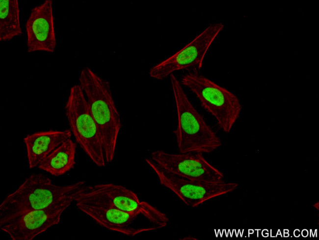 GAR1 Antibody in Immunocytochemistry (ICC/IF)