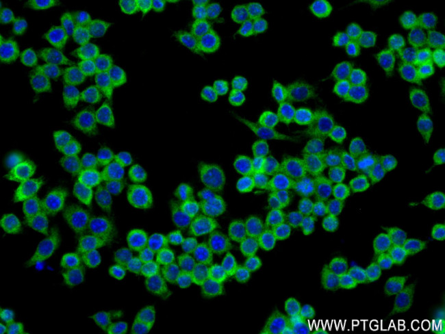 S100A9 Antibody in Immunocytochemistry (ICC/IF)