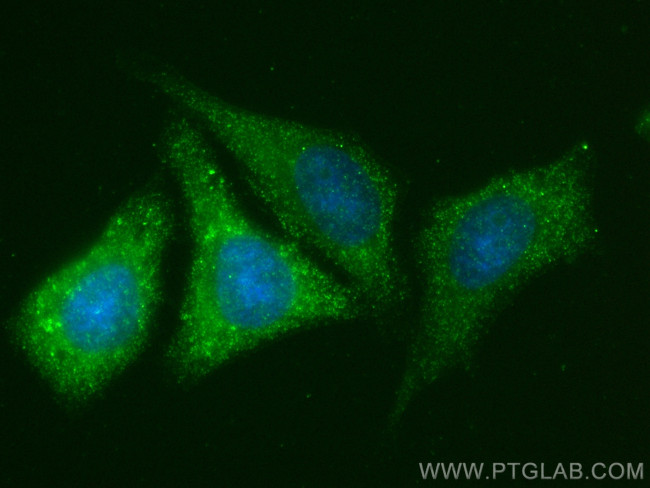 DHRS3 Antibody in Immunocytochemistry (ICC/IF)