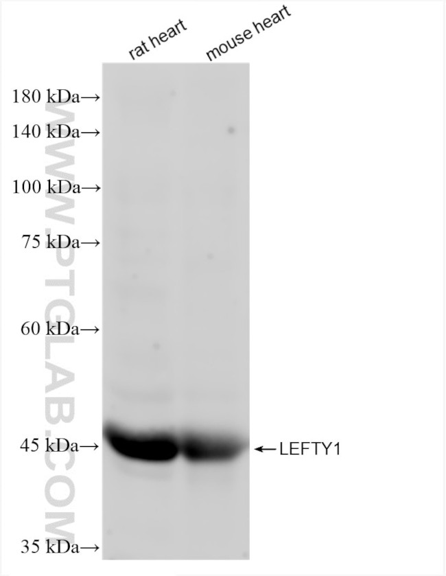 LEFTY1 Antibody in Western Blot (WB)