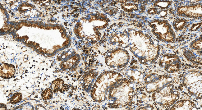 Drebrin Antibody in Immunohistochemistry (Paraffin) (IHC (P))