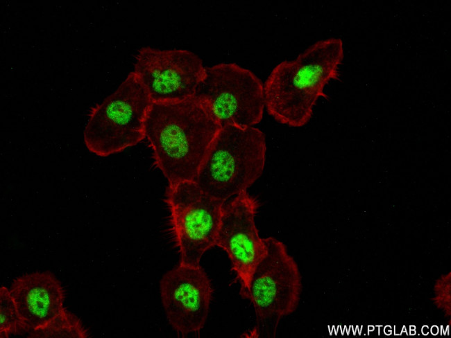 SENP1 Antibody in Immunocytochemistry (ICC/IF)