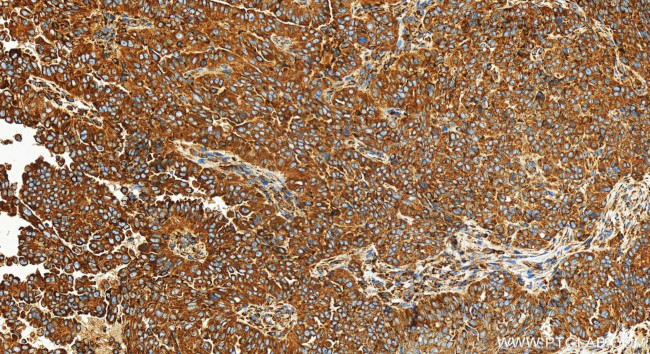 SENP1 Antibody in Immunohistochemistry (Paraffin) (IHC (P))