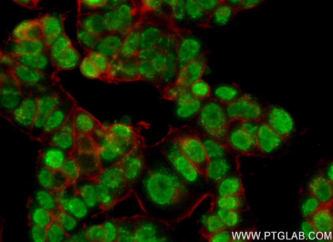 KMT2C Antibody in Immunocytochemistry (ICC/IF)