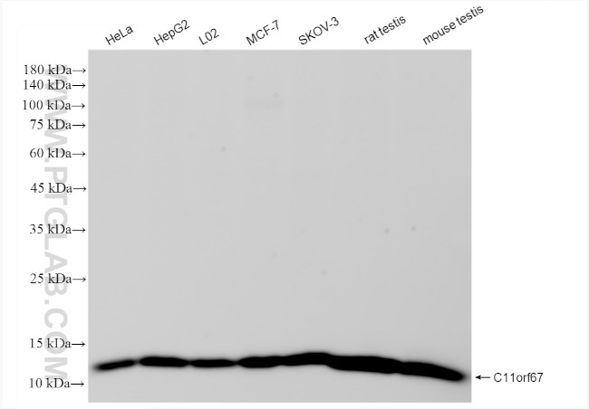 C11orf67 Antibody in Western Blot (WB)