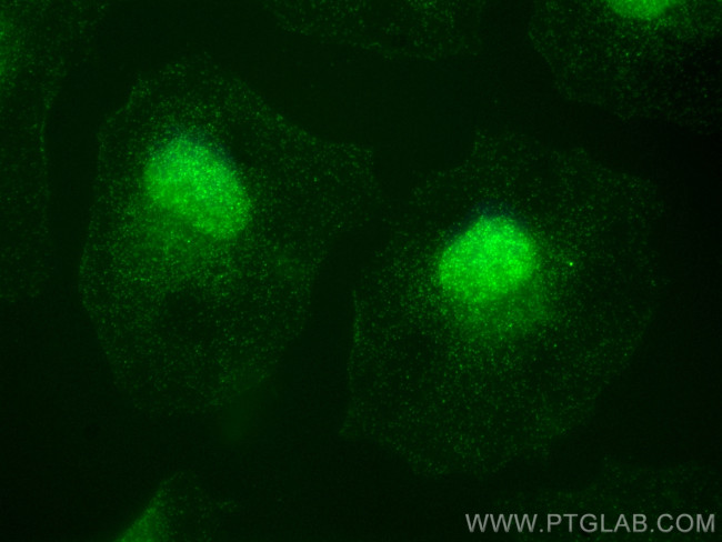 PIK3R2 Antibody in Immunocytochemistry (ICC/IF)