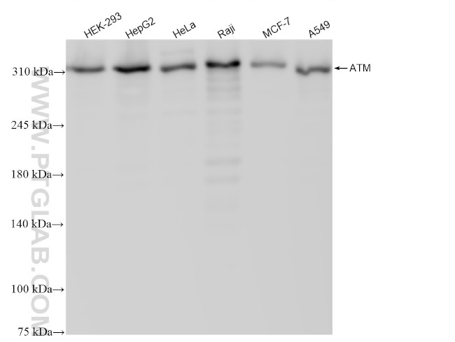 ATM Antibody in Western Blot (WB)