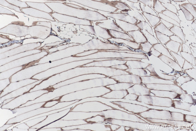 Dystrophin Antibody in Immunohistochemistry (Paraffin) (IHC (P))