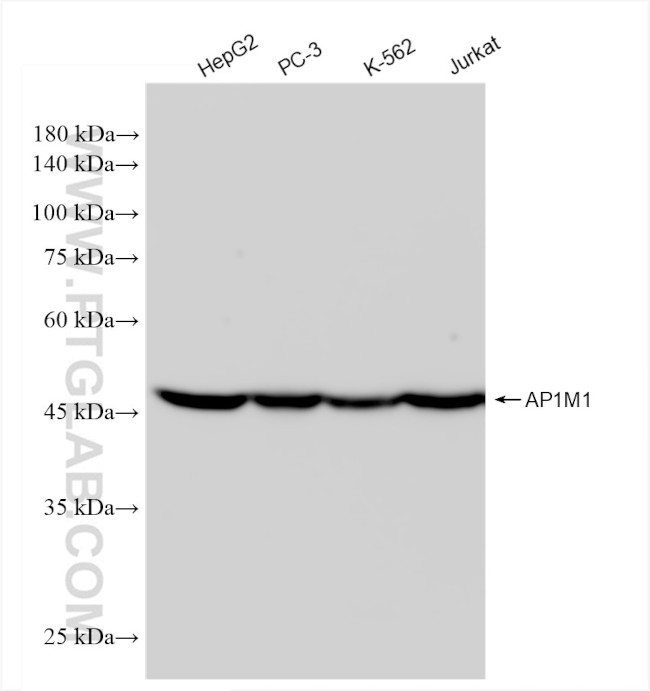 AP1M1 Antibody in Western Blot (WB)