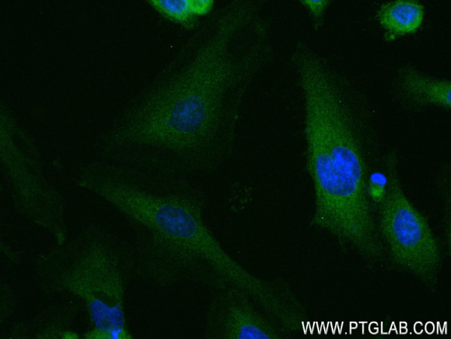 CNOT4 Antibody in Immunocytochemistry (ICC/IF)