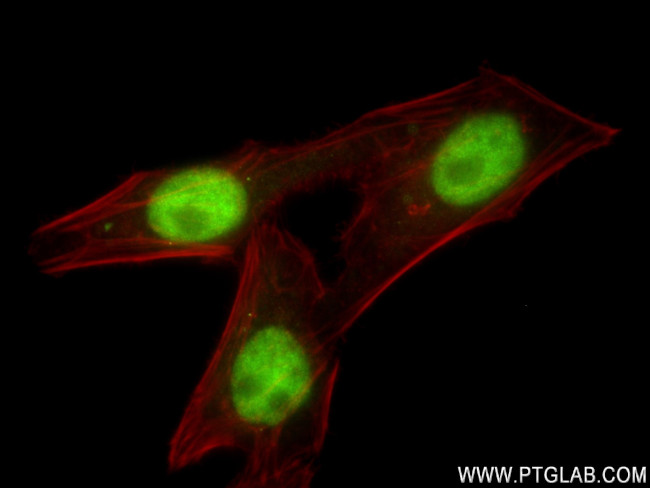 ZBTB7A Antibody in Immunocytochemistry (ICC/IF)