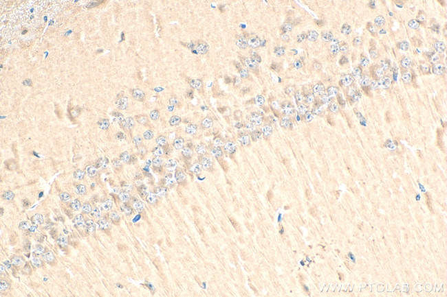 Presenilin-1 Antibody in Immunohistochemistry (Paraffin) (IHC (P))