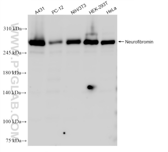 Neurofibromin 1 Antibody in Western Blot (WB)
