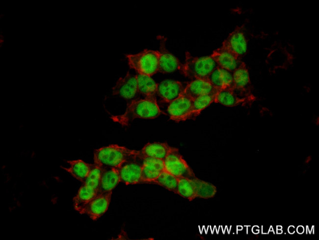 C1orf83 Antibody in Immunocytochemistry (ICC/IF)