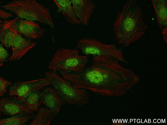 C1orf83 Antibody in Immunocytochemistry (ICC/IF)